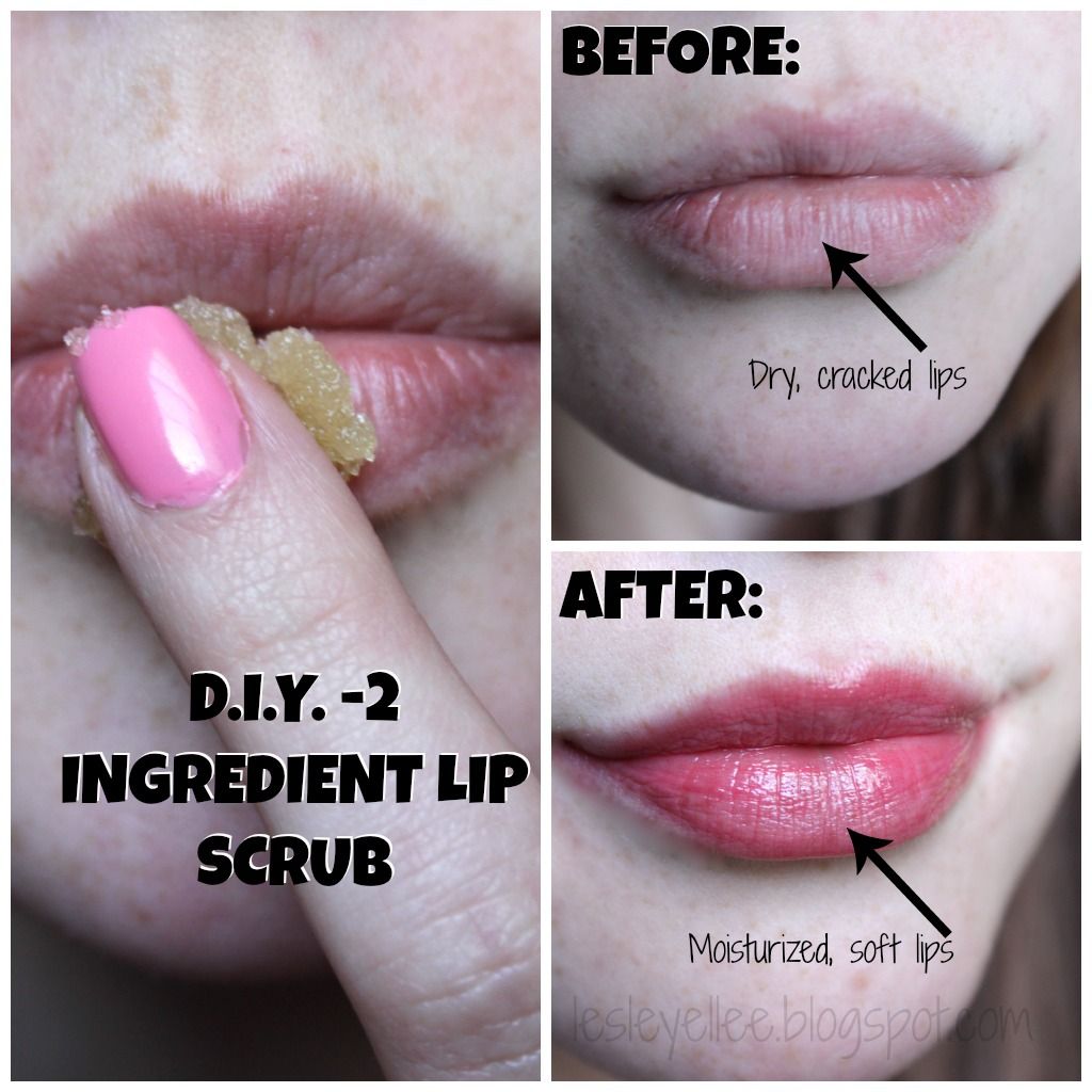 Diy Lip Scrub Before And After